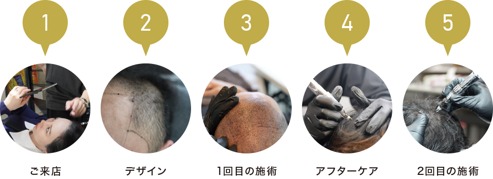 施術の流れ